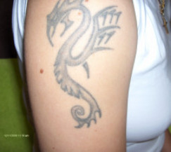 tetoválás eltávolitás